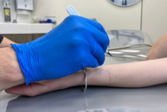 Экономия на консультации при удалении новообразований