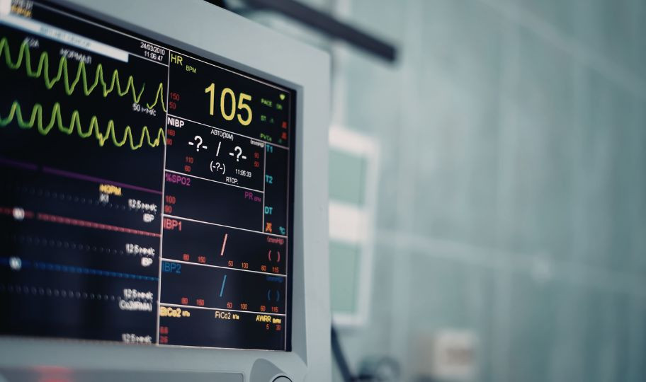 Интраоперационный мониторинг витальных функций