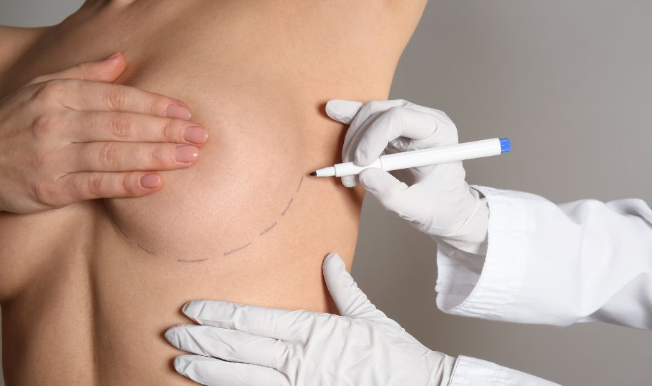 Коррекция асимметрии груди