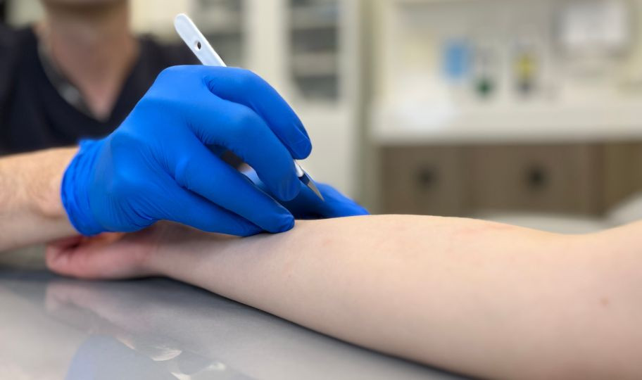 Удаление липомы хирургическим методом