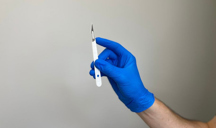 Удаление рабдомиомы хирургическим методом