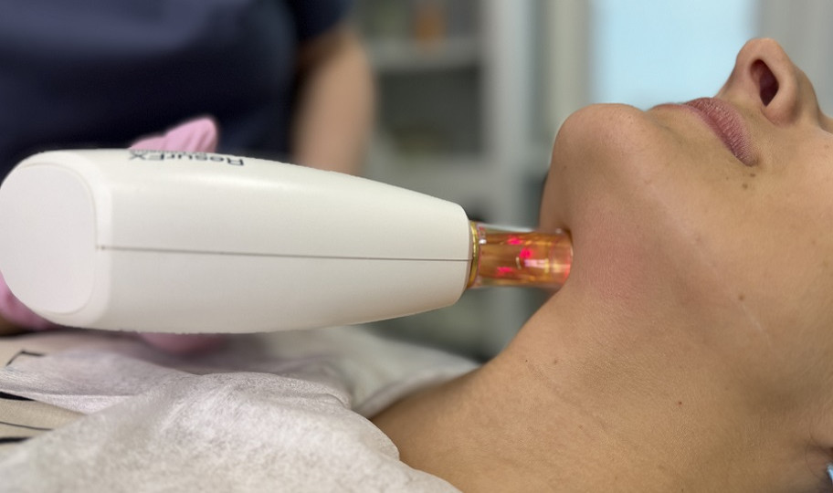 Фракционное неаблятивное лазерное омоложение (ResurFX)