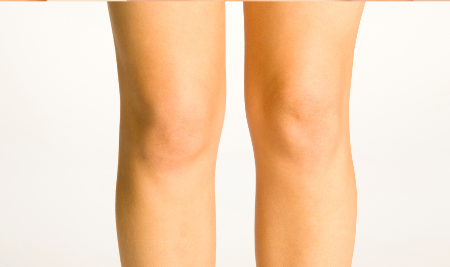 Липосакция области колен