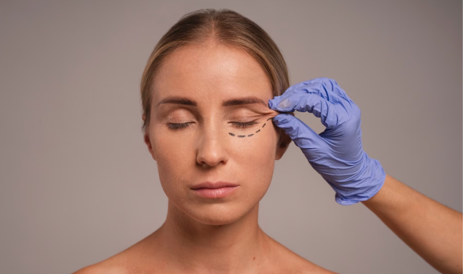 Пластика нижних век